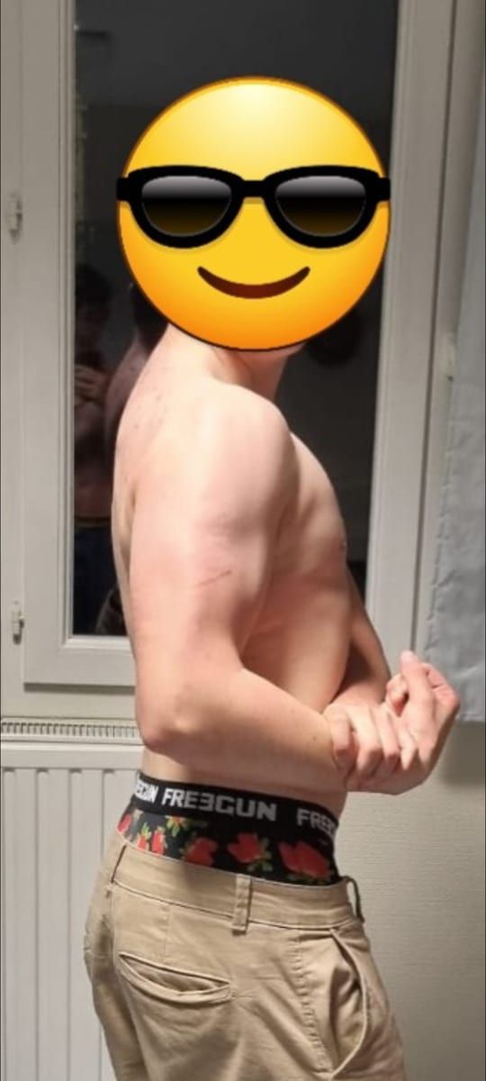 Profil von Axil